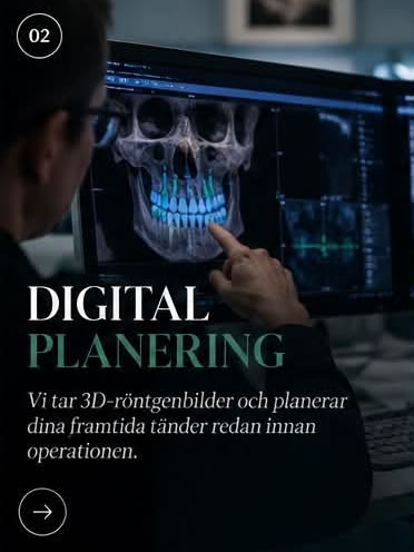Steg 2: Digital planering. Vi tar 3D-röntgenbilder och planerar dina framtida tänder redan innan operationen.